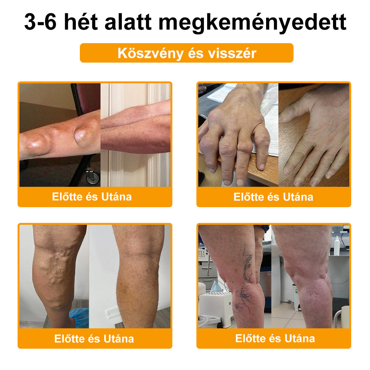 ⭐🎁Már csak 10 doboz maradt!🎁 További 40% kedvezményt adunk! Őrizd meg az egészséged! Ha most kihagyod, idén már nem lesz lehetőség!