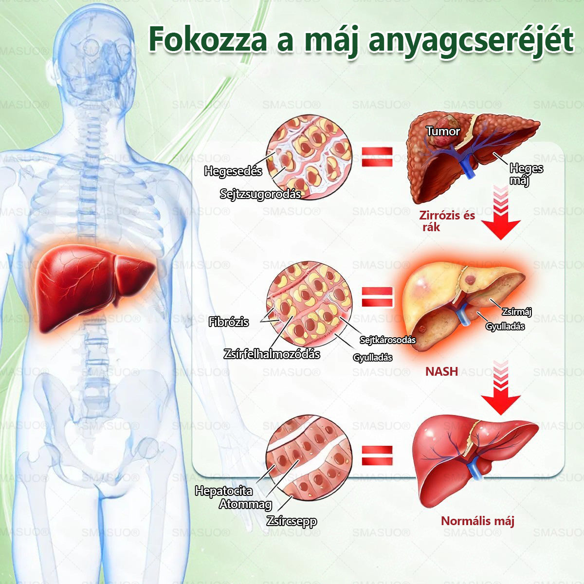 ⭐🎁 𝐏𝐙𝐆𝐎𝐍𝐄® Szuperélelmiszer Nano mikrotűs tapasz | 🇭🇺 A Magyarország és az EU egészségügyi előírásaival összhangban · 👩‍⚕️ Orvosi szakemberek ajánlásával