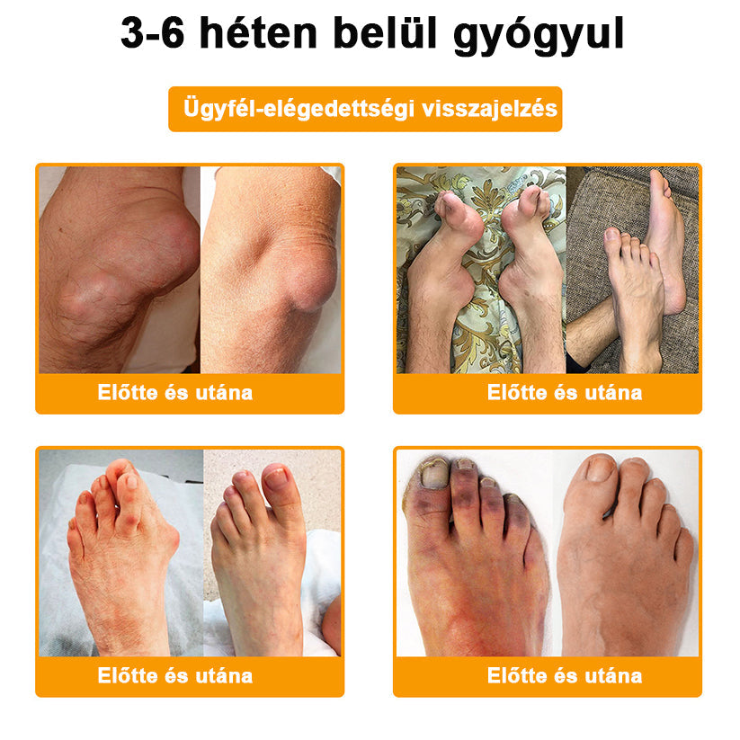 ⭐🎁Már csak 10 doboz maradt!🎁 További 40% kedvezményt adunk! Őrizd meg az egészséged! Ha most kihagyod, idén már nem lesz lehetőség!