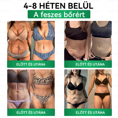 ⭐🎁 𝐏𝐙𝐆𝐎𝐍𝐄® Szuperélelmiszer Nano mikrotűs tapasz | 🇭🇺 A Magyarország és az EU egészségügyi előírásaival összhangban · 👩‍⚕️ Orvosi szakemberek ajánlásával